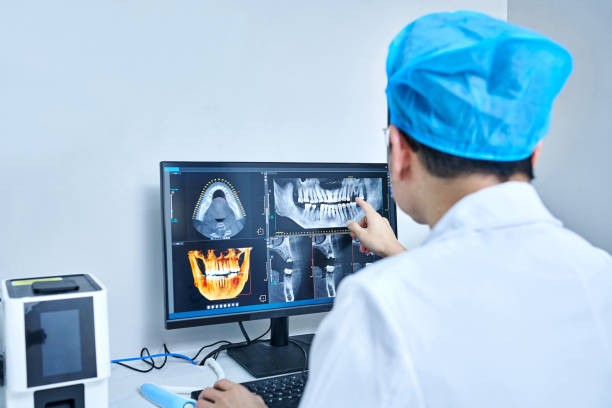 Best Knocked-Out Tooth (Avulsed Tooth) Treatment in Arcola, IL
